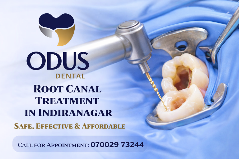 Best Root Canal Treatment in Indiranagar at Odus Dental