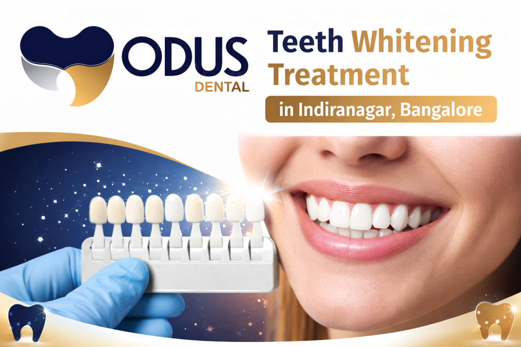 Best Teeth Whitening Treatment in Indiranagar, Bangalore for a Confident Smile