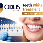 Best Teeth Whitening Treatment in Indiranagar, Bangalore for a Confident Smile